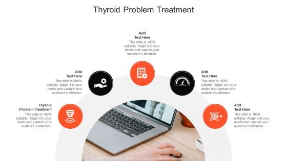 Thyroid Problem Treatment In Powerpoint And Google Slides Cpb