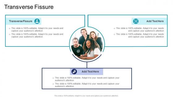 Transverse Fissure In Powerpoint And Google Slides Cpb