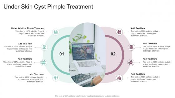Under Skin Cyst Pimple Treatment In Powerpoint And Google Slides Cpb
