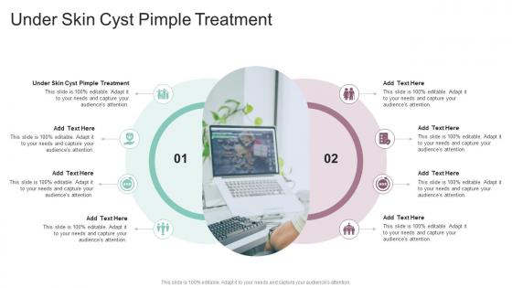 Under Skin Cyst Pimple Treatment In Powerpoint And Google Slides Cpb Under Skin Cyst Pimple Treatment In Powerpoint And Google Slides Cpb