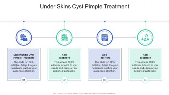 Under Skins Cyst Pimple Treatment In Powerpoint And Google Slides Cpb