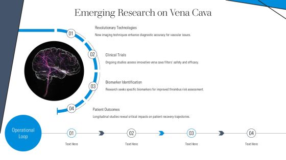 Understanding Vena Cava And Function PPT Example AT Slide16