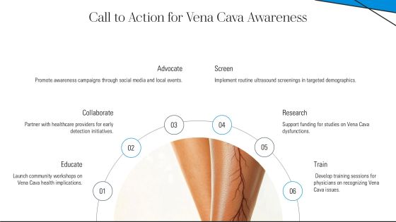 Understanding Vena Cava And Function PPT Example AT Slide24