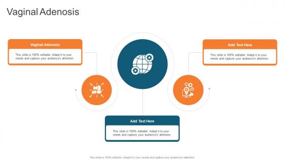 Vaginal Adenosis In Powerpoint And Google Slides Cpb