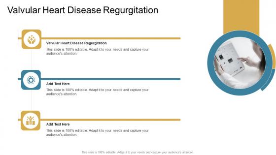 Valvular Heart Disease Regurgitation In Powerpoint And Google Slides Cpb
