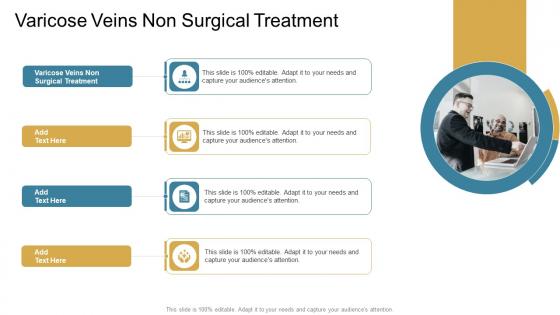 Varicose Veins Non Surgical Treatment In Powerpoint And Google Slides Cpb