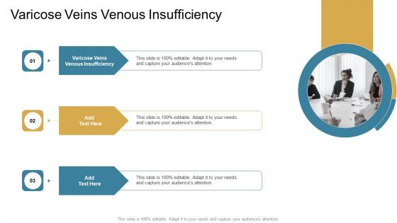 Varicose Veins Venous Insufficiency In Powerpoint And Google Slides Cpb