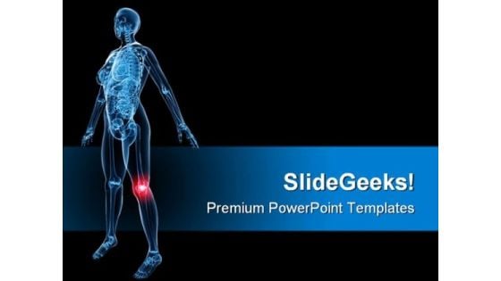 X Ray Of Painful Knee Medical PowerPoint Themes And PowerPoint Slides 0811