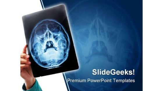 Xray Medical PowerPoint Template 0610