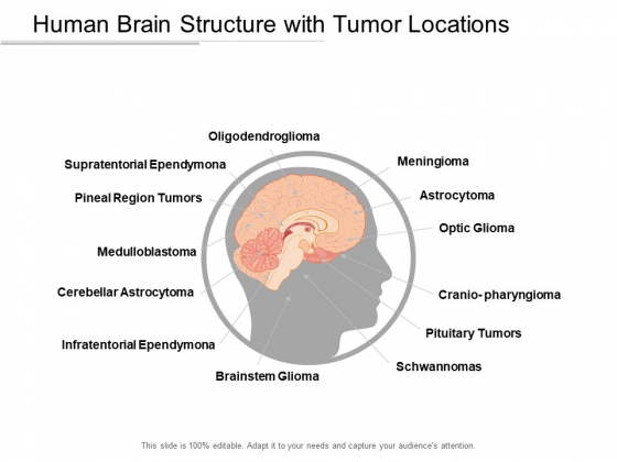 Human Brain Structure With Tumor Locations Ppt Powerpoint Presentation Ideas Example Introduction