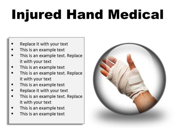 Injured Hand Medical PowerPoint Presentation Slides C