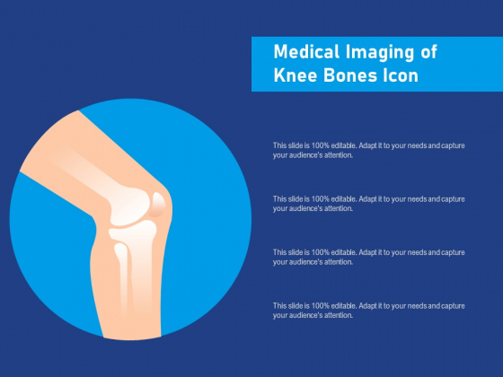 Medical Imaging Of Knee Bones Icon Ppt PowerPoint Presentation Icon Guide PDF Medical Imaging Of Knee Bones Icon Ppt PowerPoint Presentation Icon Guide PDF