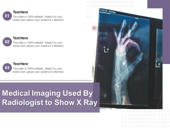Medical Imaging Used By Radiologist To Show X Ray Ppt PowerPoint Presentation Gallery Show PDF Medical Imaging Used By Radiologist To Show X Ray Ppt PowerPoint Presentation Gallery Show PDF