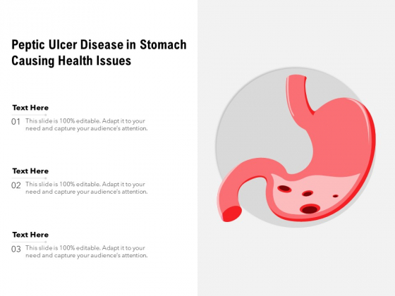 Peptic Ulcer Disease In Stomach Causing Health Issues Ppt PowerPoint Presentation Infographic Template Format Ideas PDF Peptic Ulcer Disease In Stomach Causing Health Issues Ppt PowerPoint Presentation Infographic Template Format Ideas PDF