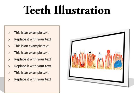 Teeth Illustration Dental PowerPoint Presentation Slides F