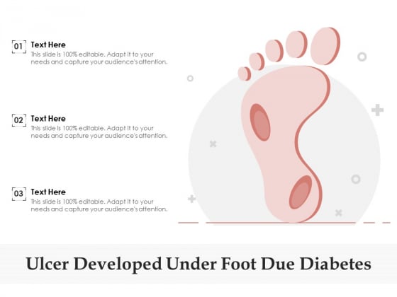 Ulcer Developed Under Foot Due Diabetes Ppt PowerPoint Presentation Pictures Objects PDF Ulcer Developed Under Foot Due Diabetes Ppt PowerPoint Presentation Pictures Objects PDF