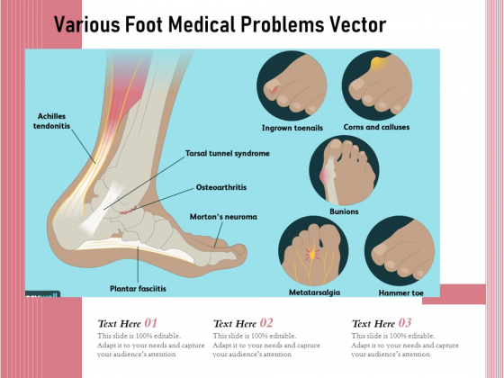Various Foot Medical Problems Vector Ppt PowerPoint Presentation Professional Format PDF Various Foot Medical Problems Vector Ppt PowerPoint Presentation Professional Format PDF