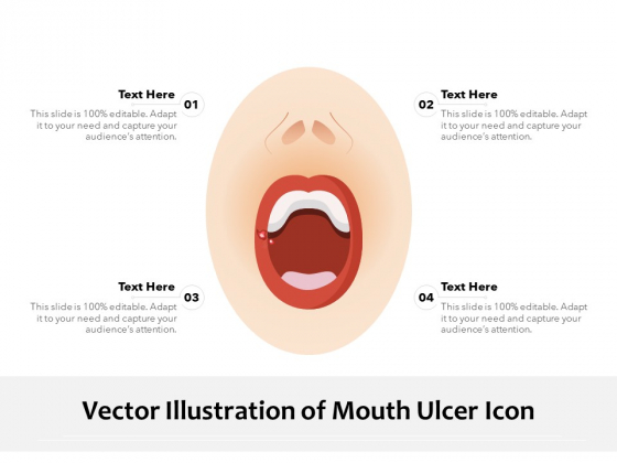 Vector Illustration Of Mouth Ulcer Icon Ppt PowerPoint Presentation Inspiration Graphics PDF Vector Illustration Of Mouth Ulcer Icon Ppt PowerPoint Presentation Inspiration Graphics PDF