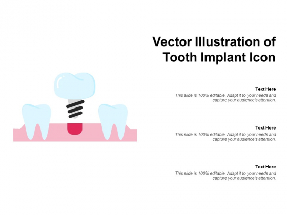 Vector Illustration Of Tooth Implant Icon Ppt PowerPoint Presentation Infographic Template Slideshow PDF Vector Illustration Of Tooth Implant Icon Ppt PowerPoint Presentation Infographic Template Slideshow PDF