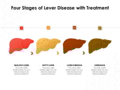 Four Stages Of Lever Disease With Treatment Ppt PowerPoint Presentation Gallery Tips PDF Four Stages Of Lever Disease With Treatment Ppt PowerPoint Presentation Gallery Tips PDF