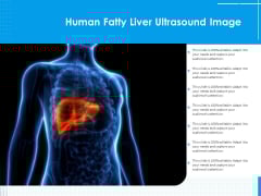 Human Fatty Liver Ultrasound Image Ppt PowerPoint Presentation File Example Topics PDF Human Fatty Liver Ultrasound Image Ppt PowerPoint Presentation File Example Topics PDF