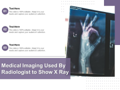 Medical Imaging Used By Radiologist To Show X Ray Ppt PowerPoint Presentation Gallery Show PDF