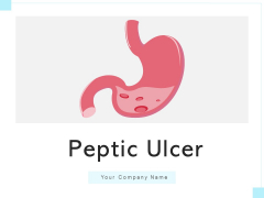 Peptic Ulcer Abdomen Area Health Issues Ppt PowerPoint Presentation Complete Deck Peptic Ulcer Abdomen Area Health Issues Ppt PowerPoint Presentation Complete Deck