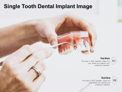 Single Tooth Dental Implant Image Ppt PowerPoint Presentation Model Outfit PDF Single Tooth Dental Implant Image Ppt PowerPoint Presentation Model Outfit PDF