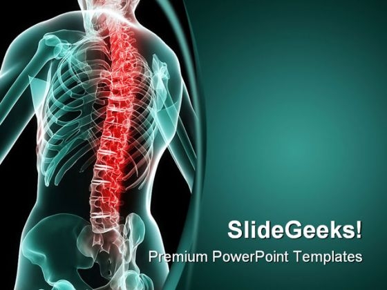 Arthritis Powerpoint Templates Slides And Graphics