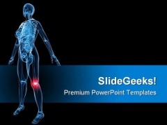 X Ray Of Painful Knee Medical PowerPoint Templates And PowerPoint Backgrounds 0811